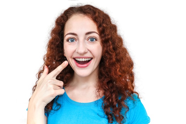 Caring For Clear Braces: How To Prevent Staining