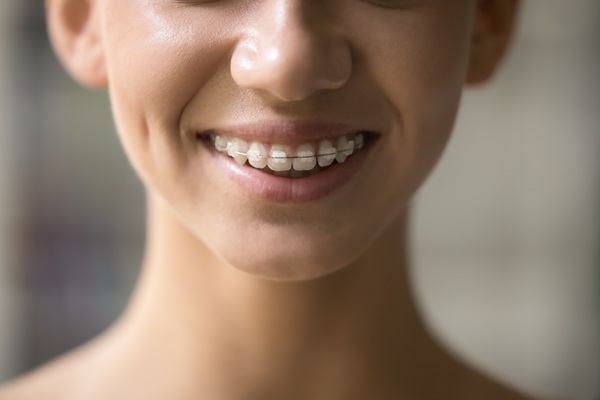 Finding The Right Teen Orthodontist For Your Child